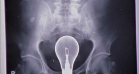 Клиника 4 сезон 2 серия